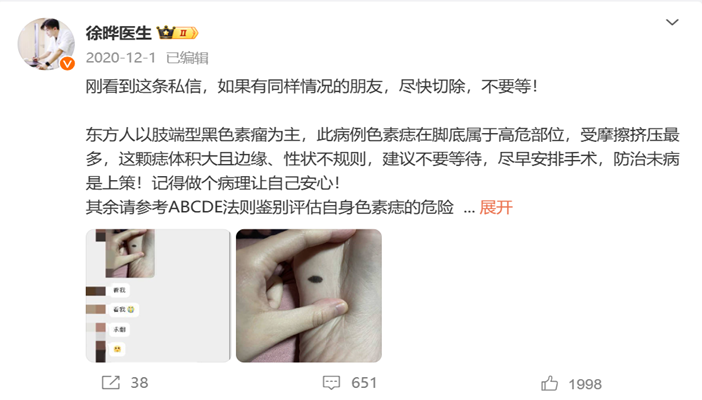 徐晔师兄在微博上科普黑色素瘤